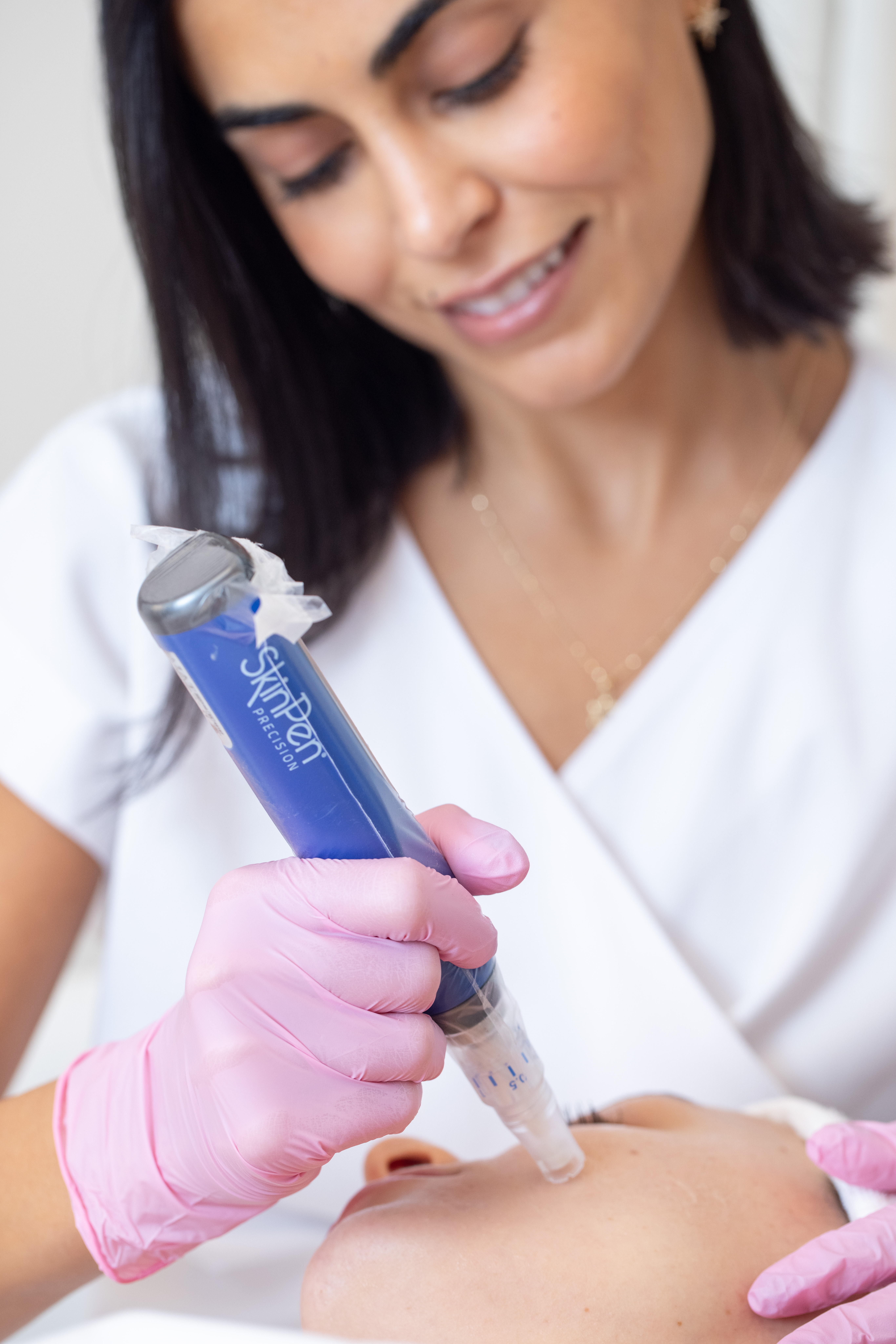 Buy 2 Microneedling, Get 1 FREE